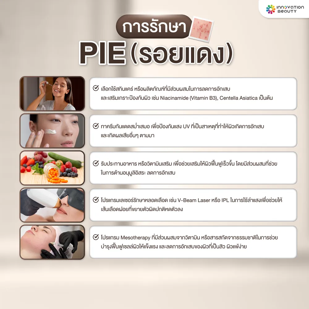 การรักษารอยแดง (PIE)