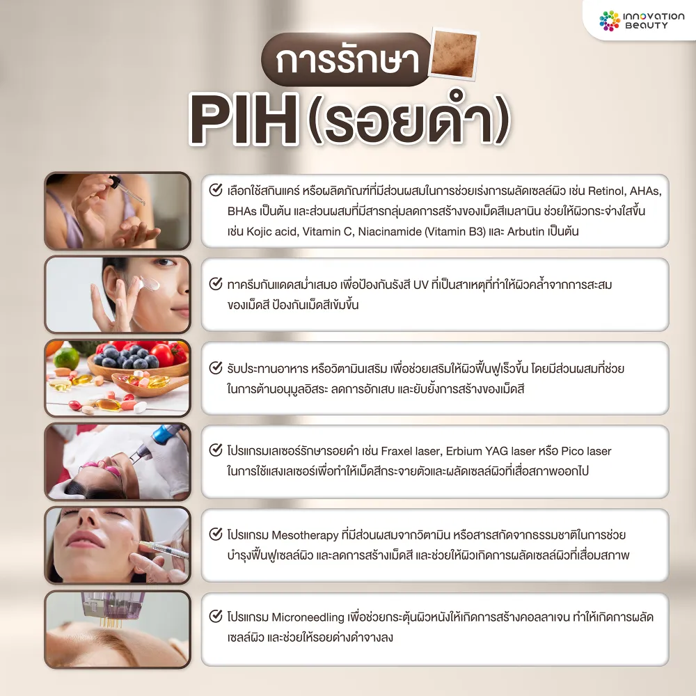 การรักษารอยดำ (PIH)