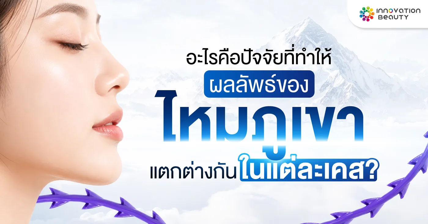 อะไรคือปัจจัยที่ทำให้ผลลัพธ์ของไหมภูเขาแตกต่างกันในแต่ละเคส?