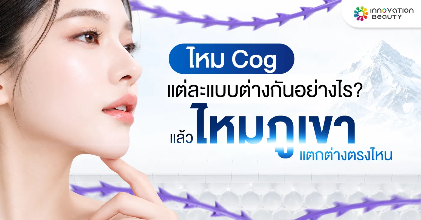 ไหม Cog แต่ละแบบต่างกันอย่างไร? แล้วไหมภูเขาแตกต่างตรงไหน