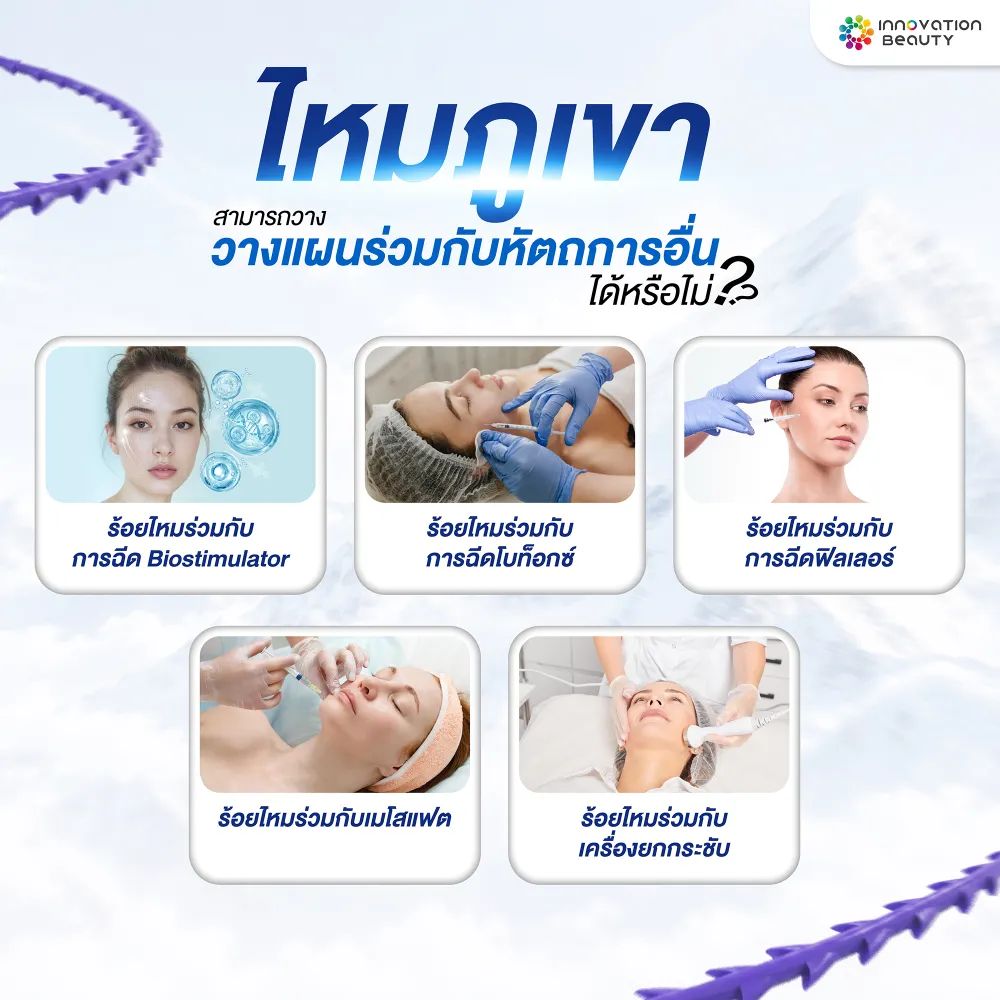 ไหมภูเขาสามารถวางแผนร่วมกับหัตถการอื่นได้หรือไม่