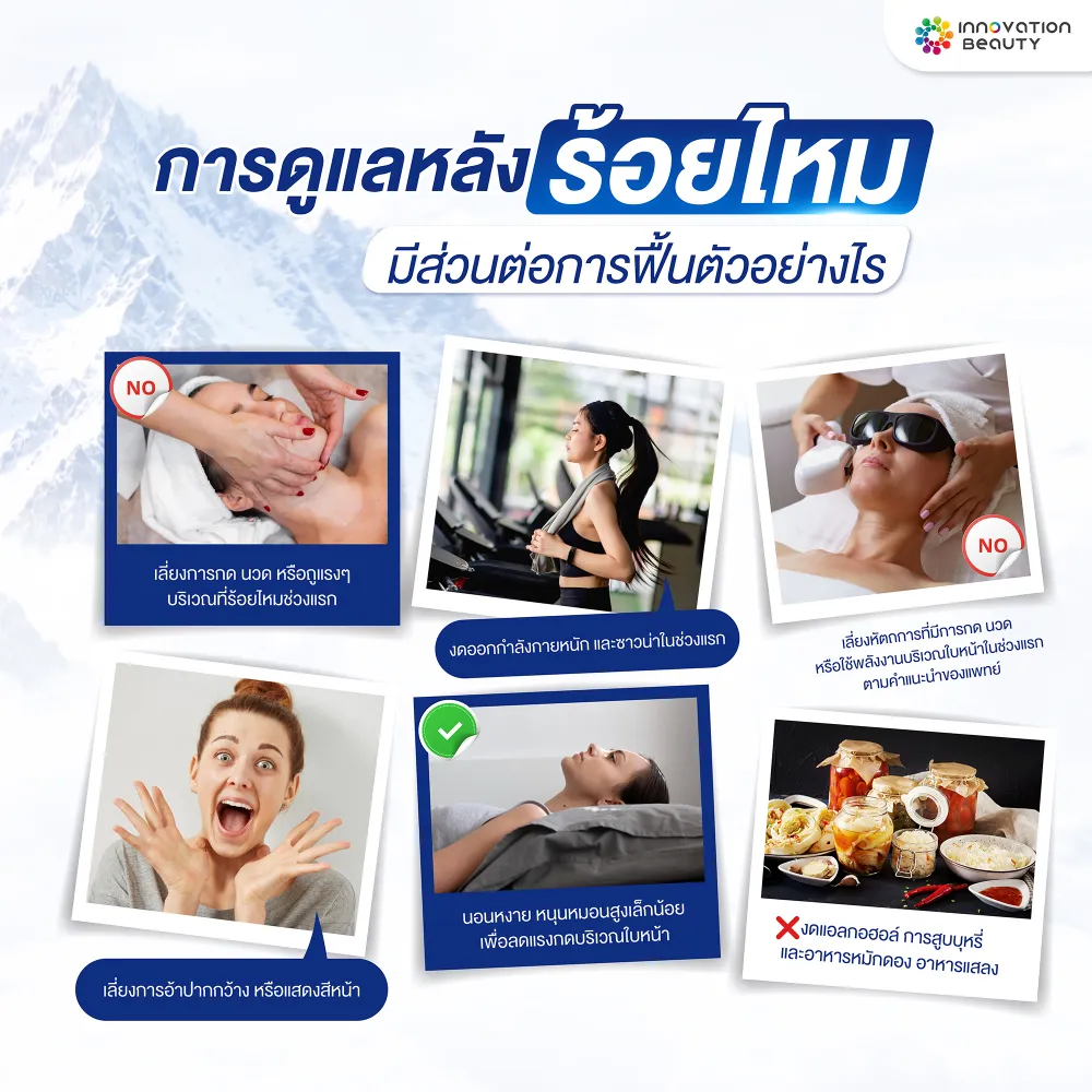 การดูแลหลังร้อยไหมมีส่วนต่อการฟื้นตัวอย่างไร