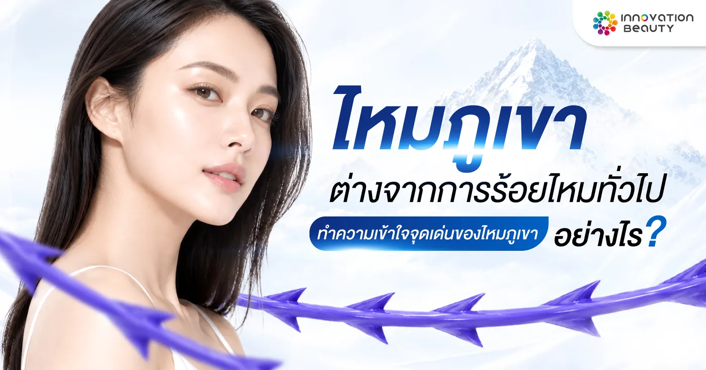 ไหมภูเขาต่างจากการร้อยไหมทั่วไปอย่างไร? ทำความเข้าใจจุดเด่นของไหมภูเขา